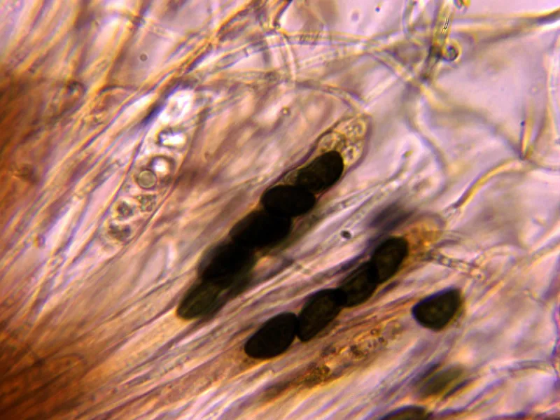 Bulgaria inquinans 10 - Ascas y paráfisis